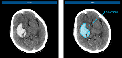 日韩欧美一区二区三区免费观看