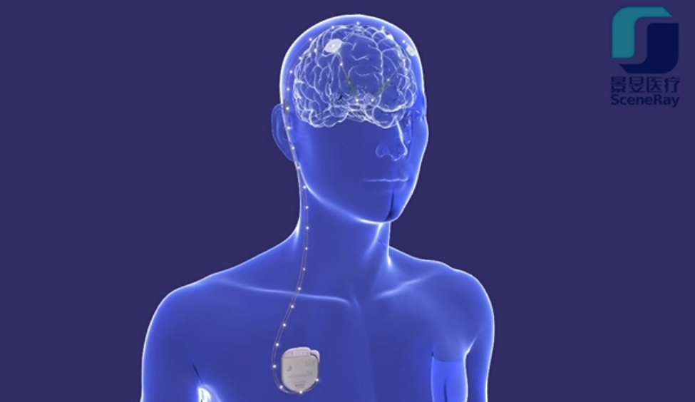 日韩欧美一区二区三区免费观看