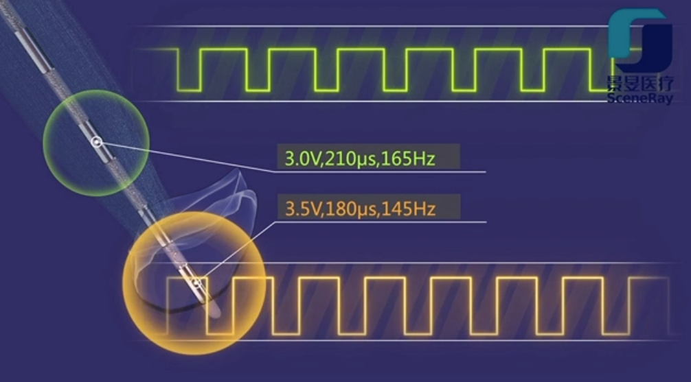 日韩欧美一区二区三区免费观看